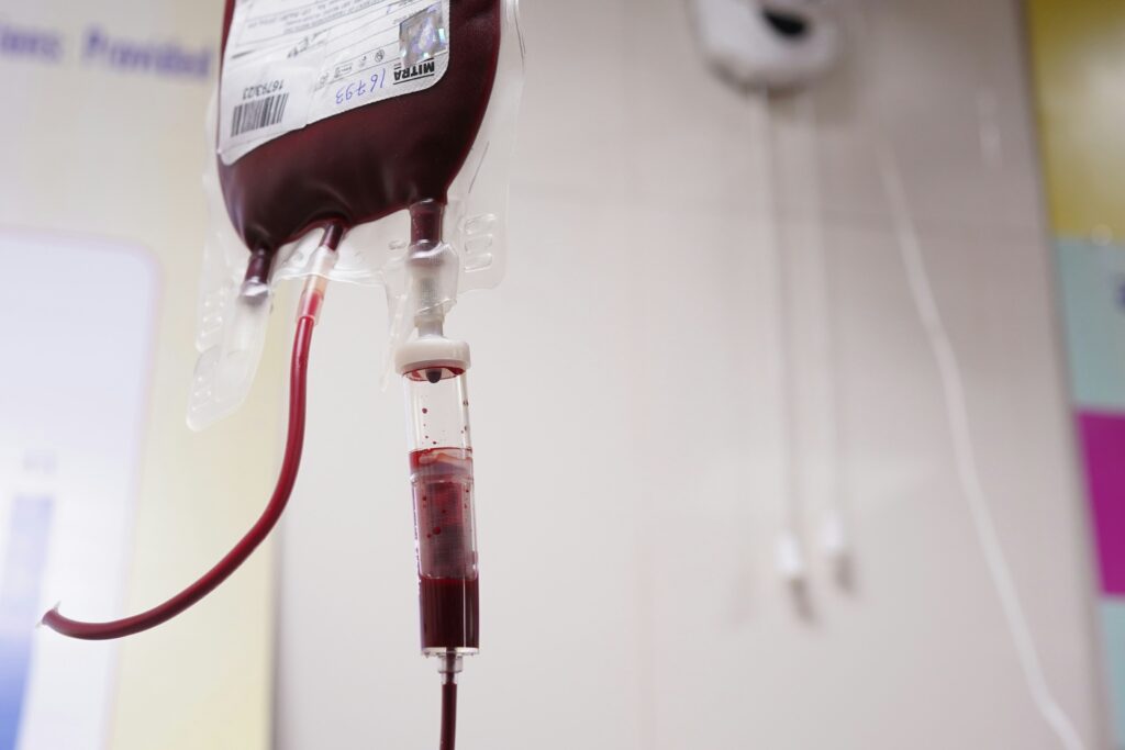 Thrombotic Thrombocytopenic Purpura (TTP)