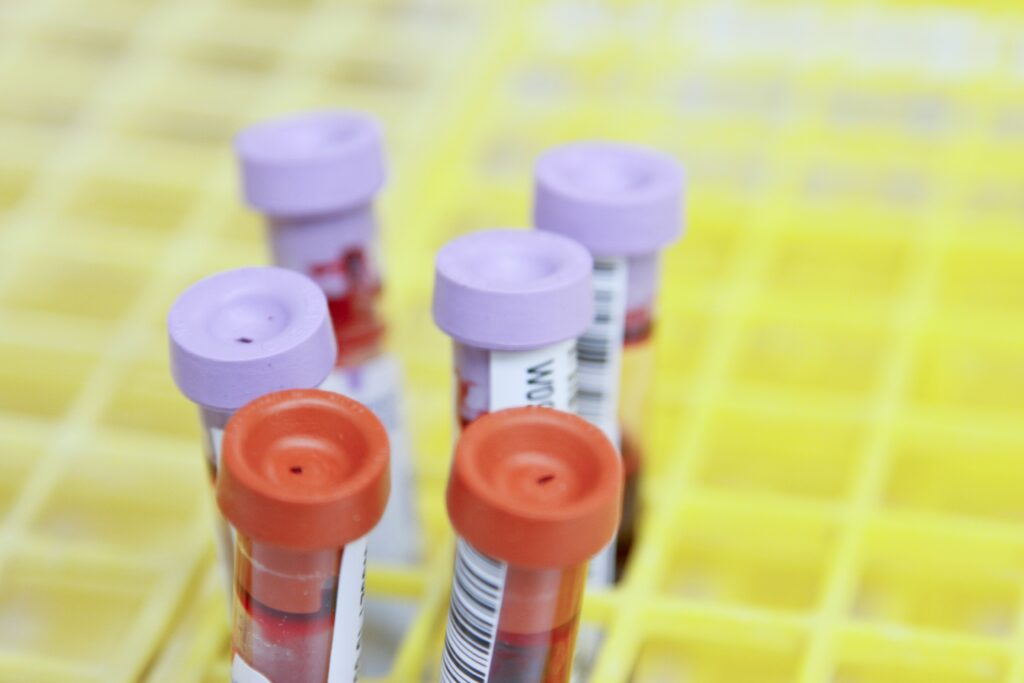 Bleeding and Coagulation Disorders