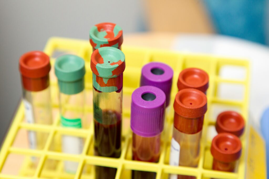 Lipid Profile