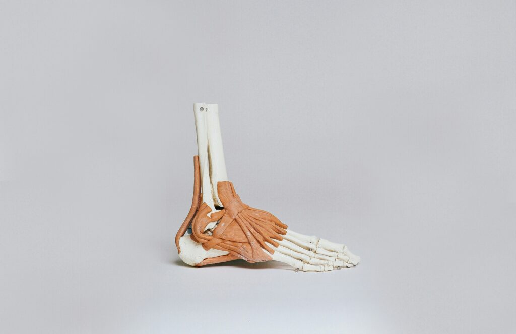 Hypermobile Joints